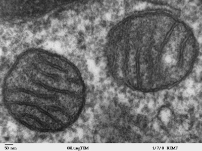 Mitochondria,_mammalian_lung_-_TEM.jpg